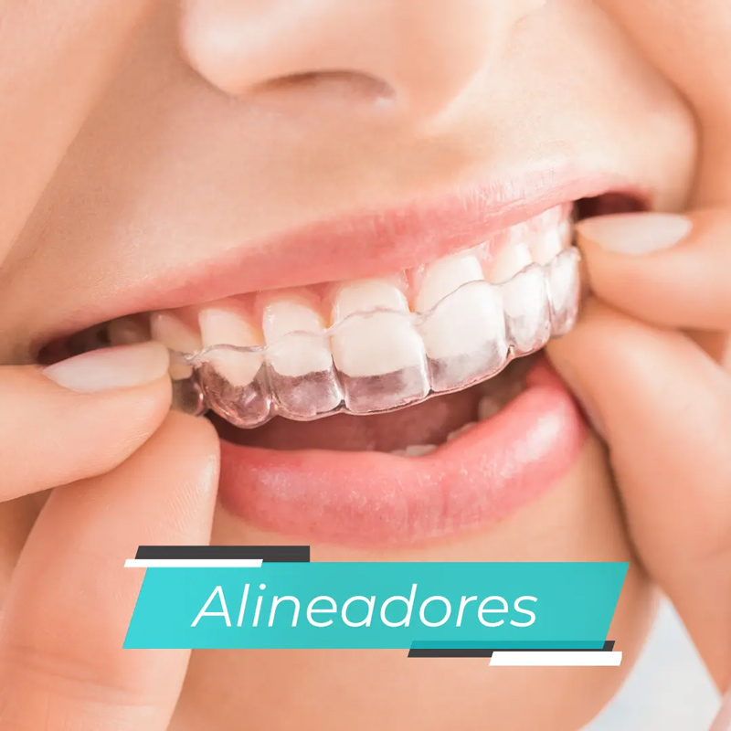 alineadores