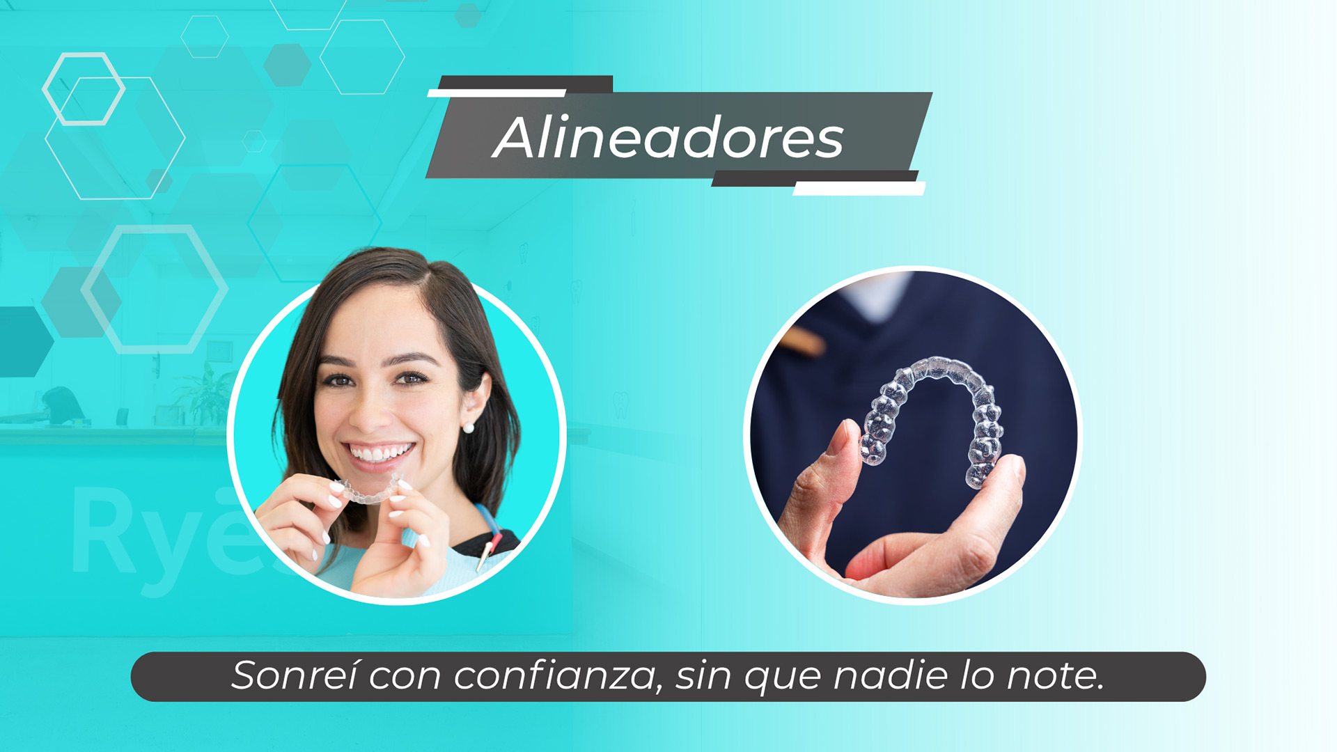 Alineadores